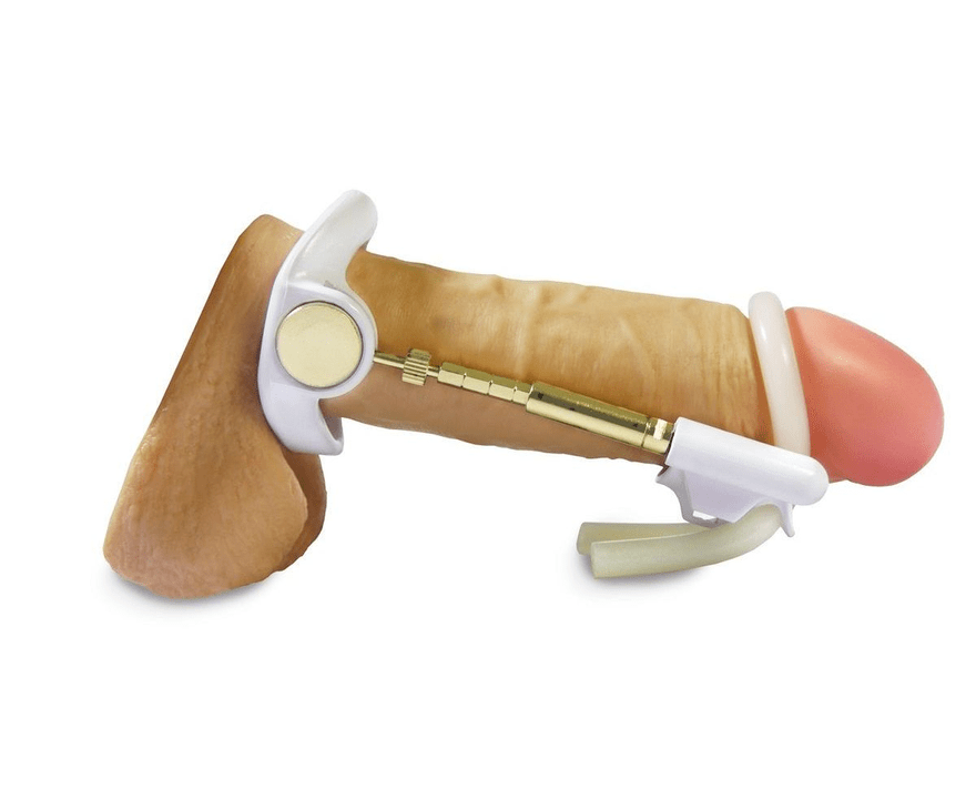 Member's expander
