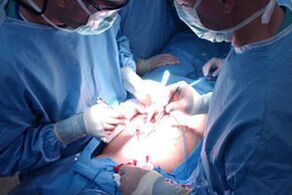 Perform a surgery to increase the penis
